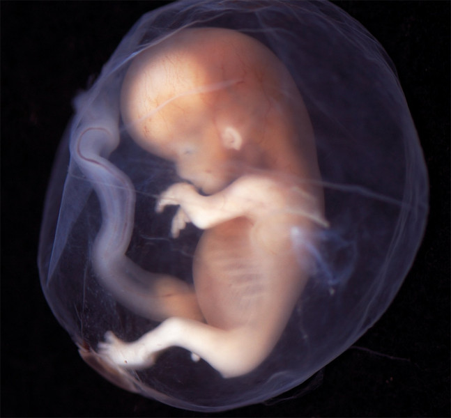 Aborto, verso il no a ricerche su tessuti fetali nel Wisconsin