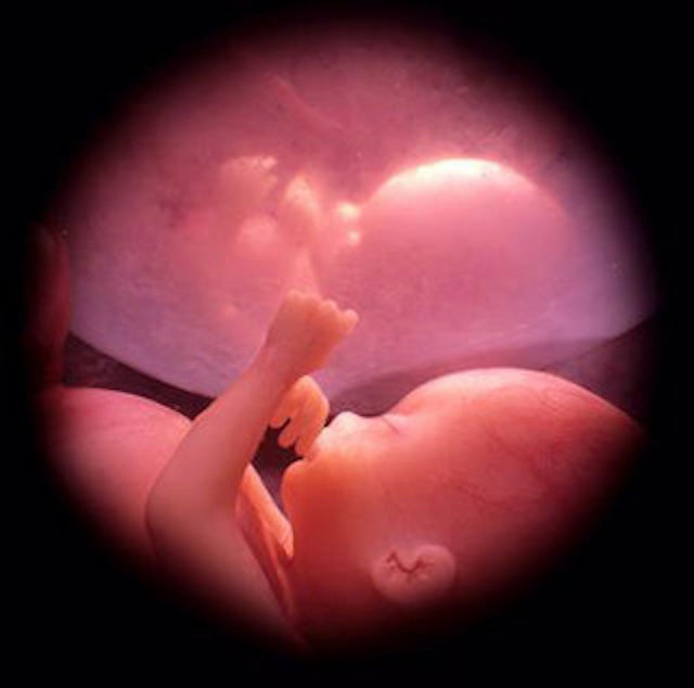 Un feto di 30 settimane, un bambino, che si succhia il pollice