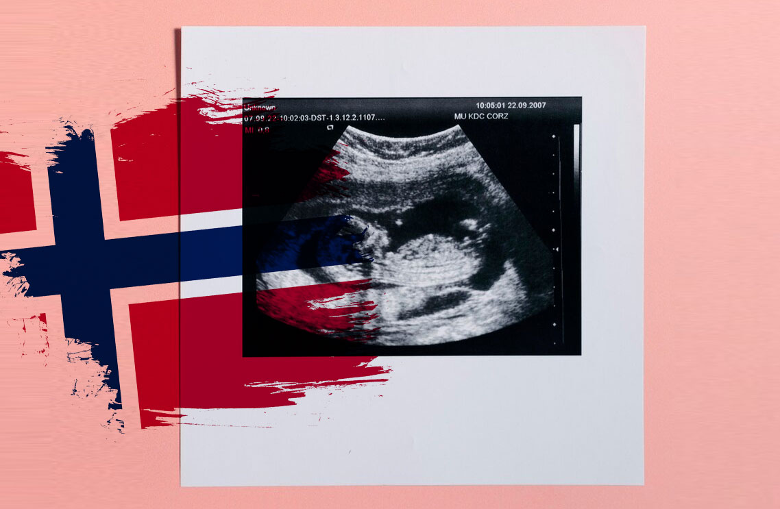 Norvegia shock: sì ad aborto selettivo per uccidere un gemello 1