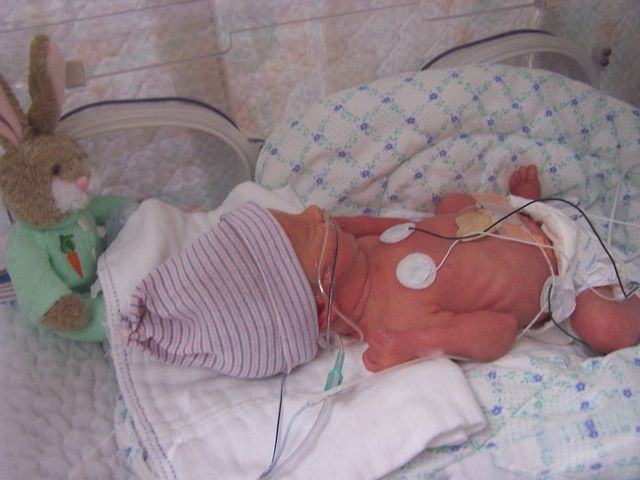 Ungheria: nasce un bambino da madre che da tre mesi era in morte cerebrale 1