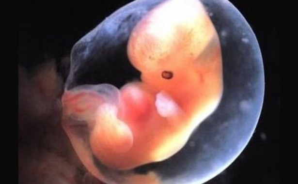 Cara Associazione Coscioni, l’embrione è una persona 1